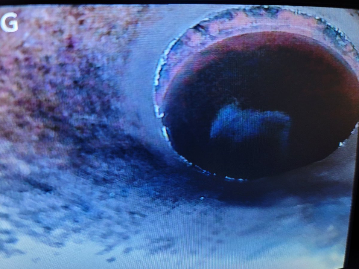 home_angel31250's tweet image. For your PROTECTION, get an INSPECTION! 🕵️‍♂️ 

**offset joints in sewer line can cause clogging and potential back up...

AngeloHomeInspection.com 

#sewerinspection #plumbingservices #SewerScope #foryoupagereels #sanangelorealestate #realestateinspection #fyp #homeinspection #home