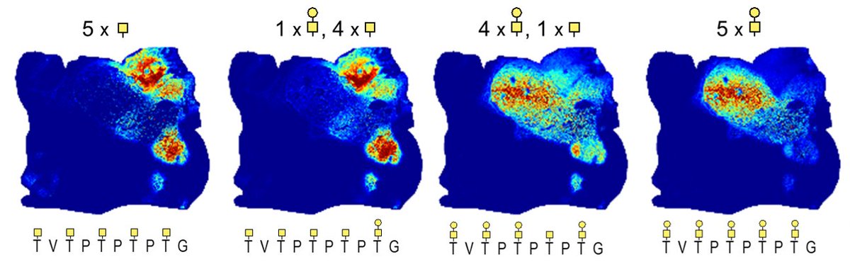 Stacy Malaker (@stacymalaker) on Twitter photo 🚨Check out our new #glycotime preprint: Glycosite Mapping and in situ Imaging of MUC2 Glycopeptides via On-slide Digestion with Mucinase StcE! 🥳<a href="/SC_Lowery/">Sarah Lowery</a> et al used MALDI IMS and intact glycoproteomics to understand spatial distribution of mucins: doi.org/10.1101/2024.0… 🧵👇 🚨Check out our new #glycotime preprint: Glycosite Mapping and in situ Imaging of MUC2 Glycopeptides via On-slide Digestion with Mucinase StcE! 🥳<a href="/SC_Lowery/">Sarah Lowery</a> et al used MALDI IMS and intact glycoproteomics to understand spatial distribution of mucins: doi.org/10.1101/2024.0… 🧵👇
