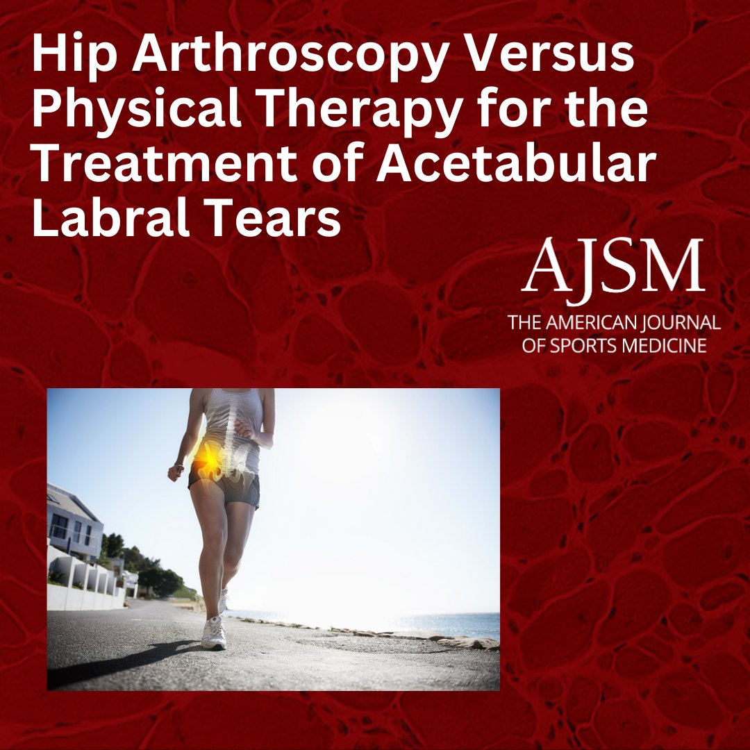 AOSSM Journals (@aossmjournals) on Twitter photo An RCT from <a href="/MassGenBrigham/">Mass General Brigham</a> found that, for patients >40 years with limited osteoarthritis, hip arthroscopy led to better functional outcomes than PT alone at 2-year follow-up. ow.ly/jIua50TeIYW <a href="/SDMartinMD/">Dr. Scott Martin</a> <a href="/StephenGillinov/">Stephen Gillinov, MD</a> <a href="/kavehtorabian/">Kaveh Torabian</a> #AJSM An RCT from <a href="/MassGenBrigham/">Mass General Brigham</a> found that, for patients >40 years with limited osteoarthritis, hip arthroscopy led to better functional outcomes than PT alone at 2-year follow-up. ow.ly/jIua50TeIYW <a href="/SDMartinMD/">Dr. Scott Martin</a> <a href="/StephenGillinov/">Stephen Gillinov, MD</a> <a href="/kavehtorabian/">Kaveh Torabian</a> #AJSM