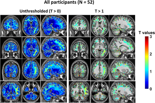 #NewPaper supported by NIF <a href="/neuraimaging/">NeuRA Imaging</a>:

Effect of Ethanol on Brain Electrical Tissue Conductivity in Social Drinkers

doi.org/10.1002/jmri.2…

<a href="/neuraustralia/">NeuRA (Neuroscience Research Australia)</a> <a href="/jmri_ismrm/">JMRI</a>