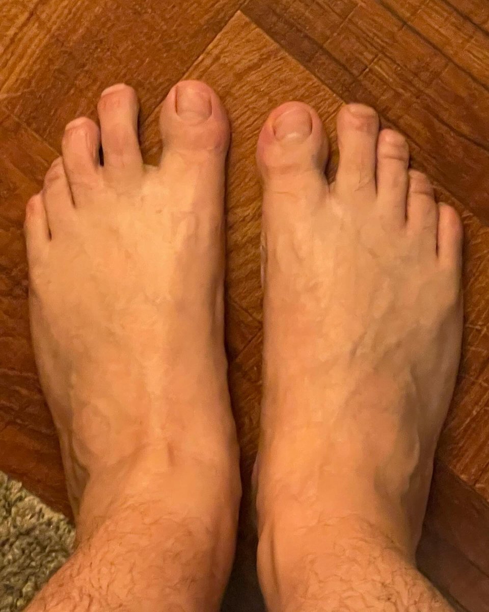 Post pedi feet. Much needed!