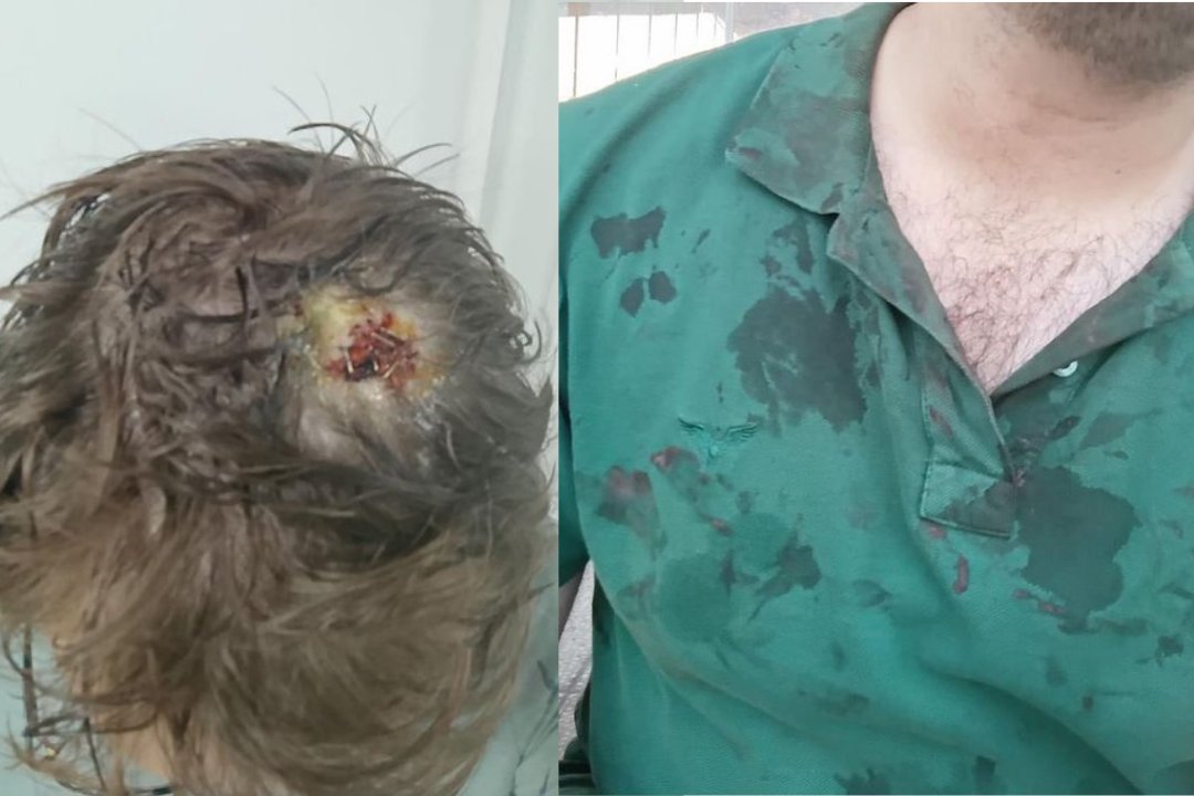 Bunlara en ağır cezayı süratle vermenizi bekliyoruz. 
<a href="/adalet_bakanlik/">T.C. Adalet Bakanlığı</a> 
<a href="/csbgovtr/">T.C. Çevre, Şehircilik ve İklim Dğş. Bakanlığı</a> 
Konunun takipçisi olup hukuki destek vermeye ne dersiniz?
<a href="/TMMOB1954/">TMMOB</a> 

Tekirdağ'da yapı denetimde çalışan bir inşaat mühendisi, sahada bulduğu eksikleri ustaya söylemesi üzerine şantiyedeki