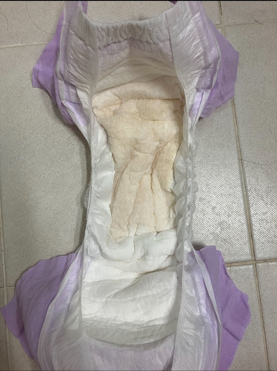 그저께 스카에서 쉬햇당…