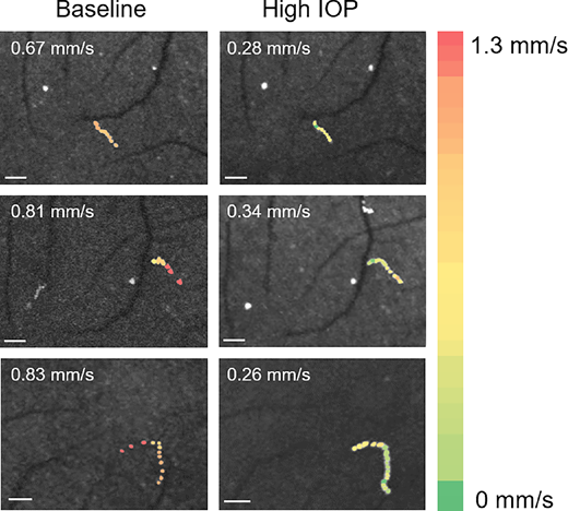 IOVS Journal tweet media