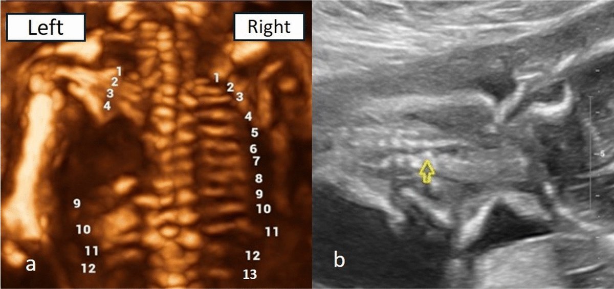 Journal Ultrasound tweet media