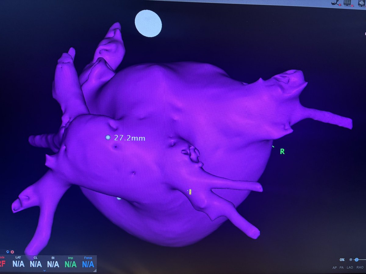 Kevin Vernooy tweet media