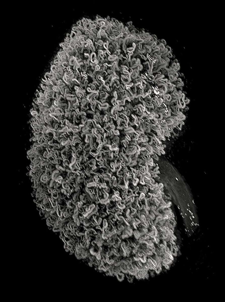 Some kidney ramen 🍜 (proximal tubules) for this #FluorescenceFriday
