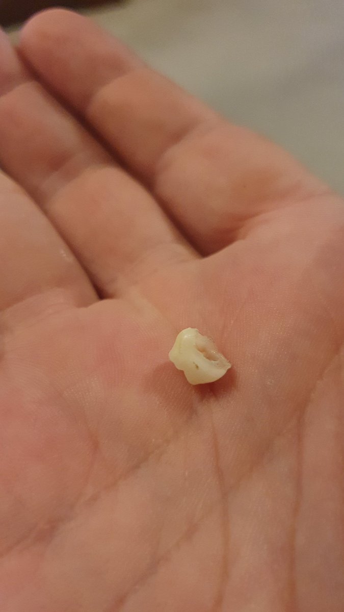 I'm a separated parent and it's a "Dad's Weekend" with my son who turns 10 tomorrow. His wobbly tooth came out tonight so I also get to be the tooth fairy...... but he obviously knows that's make believe :)