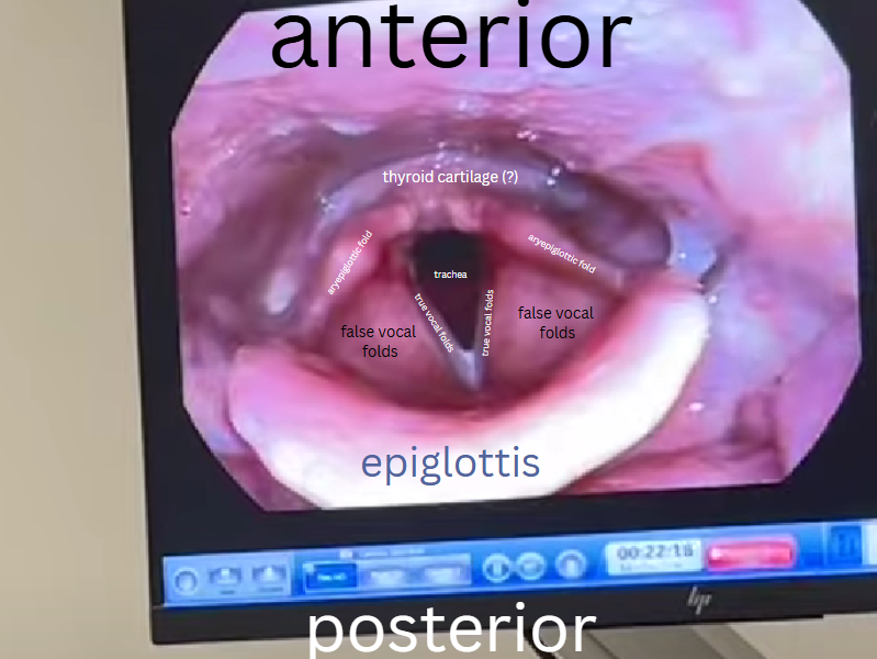 enrgeticwarrior's tweet photo. SO BEAUTIFUL💜 i deleted my other tweet because from this view you can't actually see his cricoid cartilage and i refuse to have anything anatomically incorrect on this page https://t.co/yFamgjYTSZ