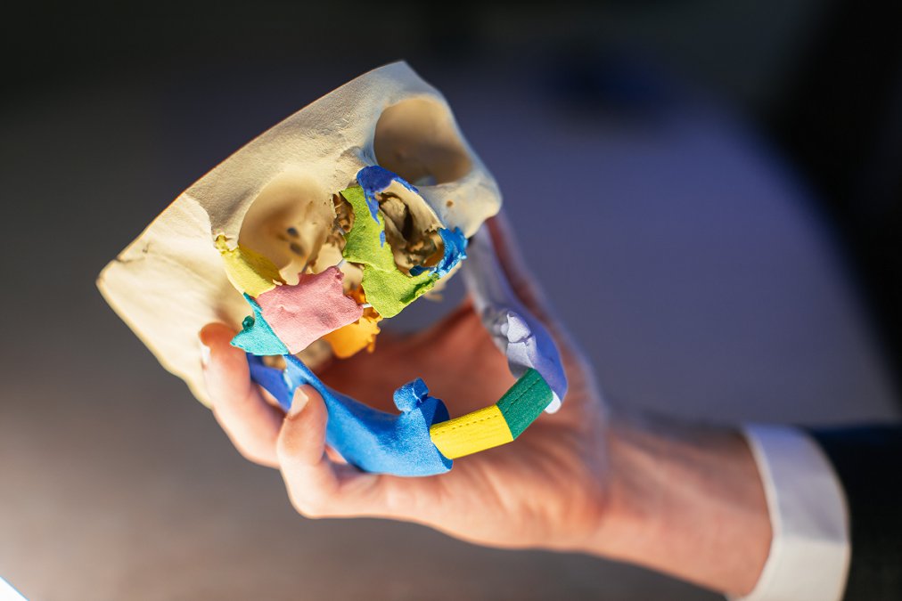 MayoClinicENT's tweet image. Pursuing Possible tells the story of how Mayo Clinic is transforming surgery with our medical 3D printing technology and anatomical models that enable greater accuracy and precision, and allow for quicker recovery time for patients.

tinyurl.com/ENT-HNS

#Medical3DPrinting