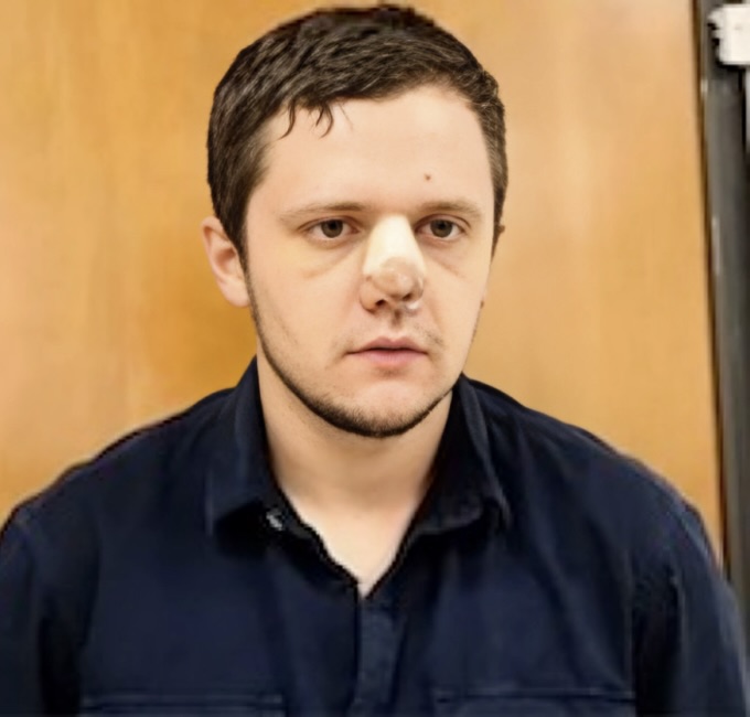 illicitinv's tweet image. #Guilty #Culpable #CJNG Rubén Oseguera González, &apos;El Menchito&apos;, de 34 años, es declarado culpable en Washington D.C. de dos cargos: narcotráfico y posesión de armas. ¿Cuántos años creen que le darán de sentencia? (Foto de su última captura en junio de 2015, recién operado de la…