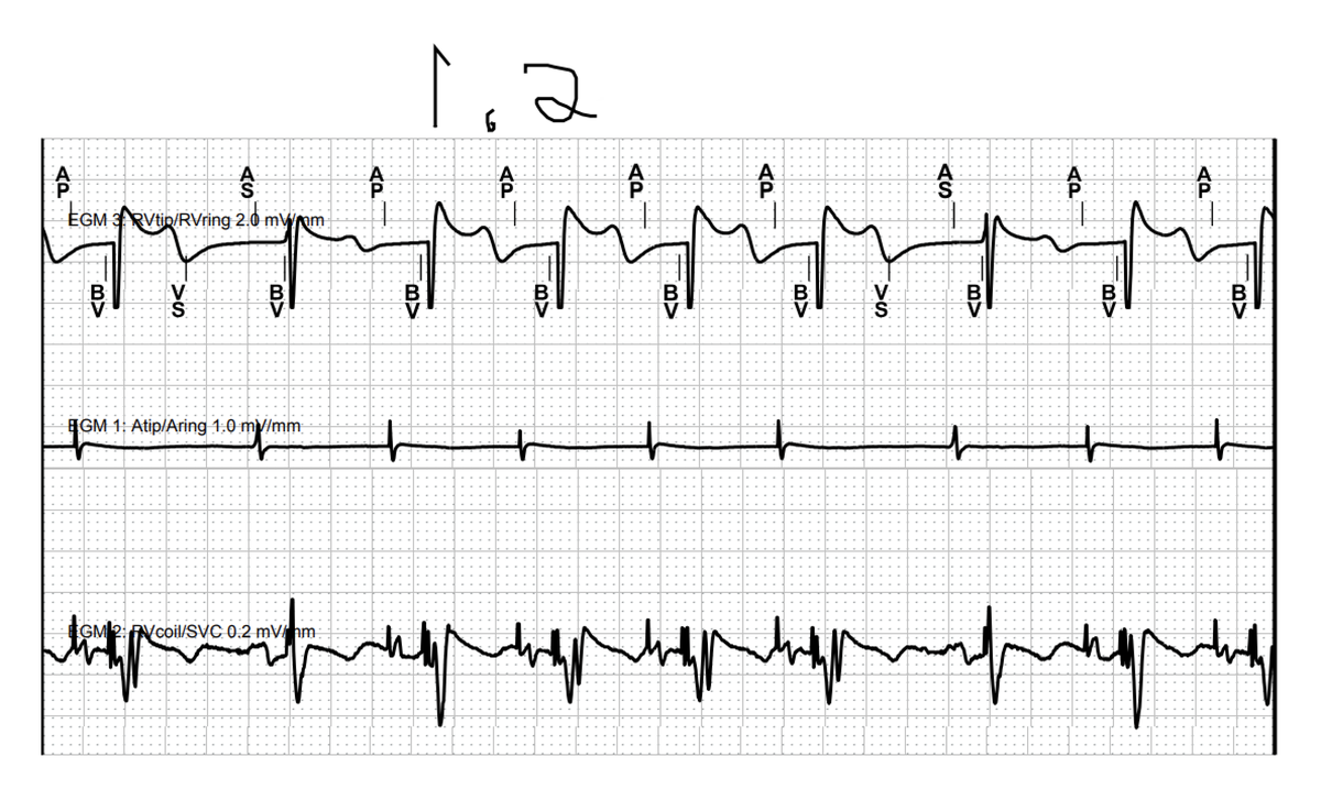 Jeffrey M Vinocur tweet media