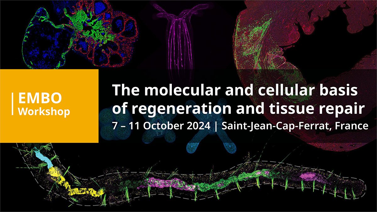 Rottinger_Lab (@rottingerl) on Twitter photo Congratulations to <a href="/JunsuKang2/">Junsu Kang</a> , Daniel Wehner @WehnerLab & Helen Blau for their ISRB Rising Stars (JK, DW) and Lifetime Achievement (HB) awards! Stoked that they will receive the awards and present their work at the upcoming 2024 #EMBOtissueRepair workshop. Congratulations to <a href="/JunsuKang2/">Junsu Kang</a> , Daniel Wehner @WehnerLab & Helen Blau for their ISRB Rising Stars (JK, DW) and Lifetime Achievement (HB) awards! Stoked that they will receive the awards and present their work at the upcoming 2024 #EMBOtissueRepair workshop.