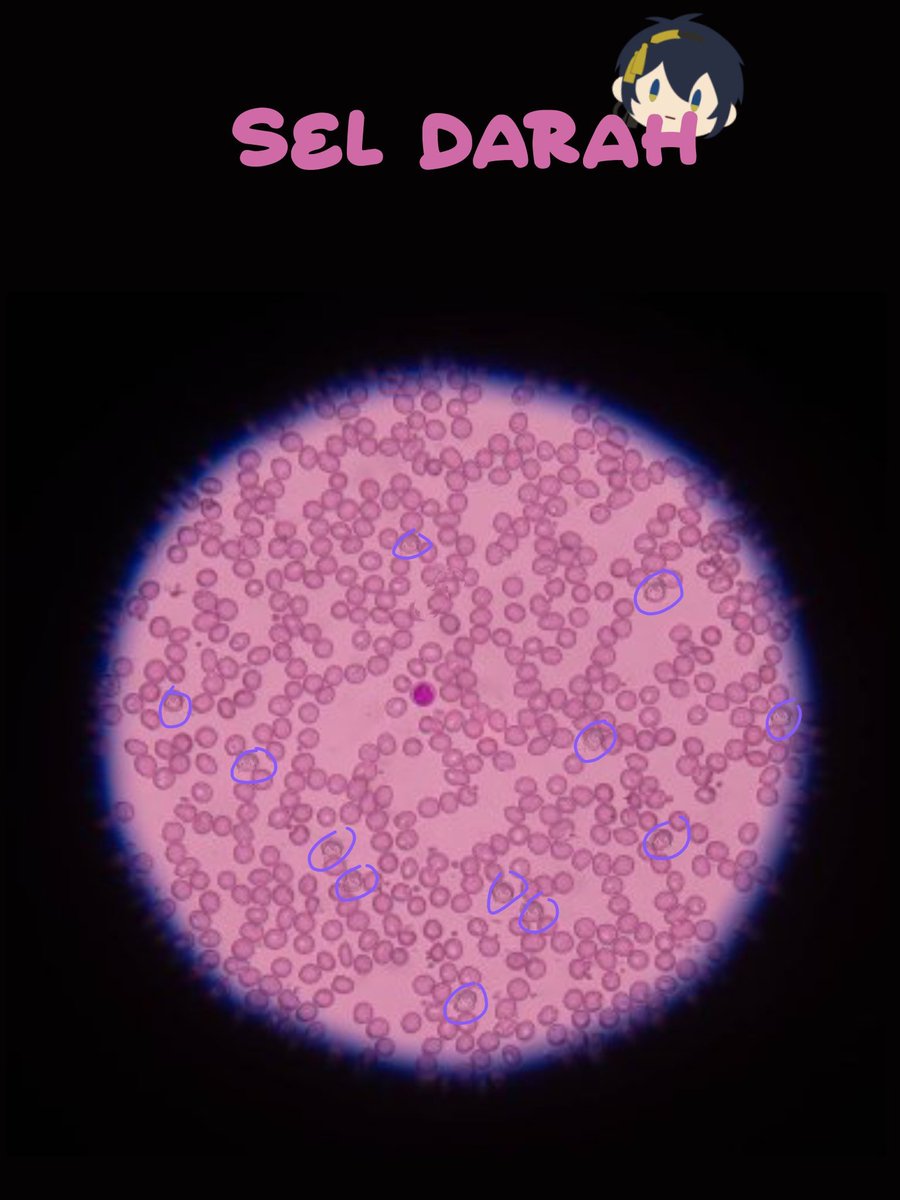 Ushijima menghela nafas pelan, ia mulai melingkarkan tanpa sepatah katapun.

"sudah selesai, sensei." 

kemudian memngumpulkannya.