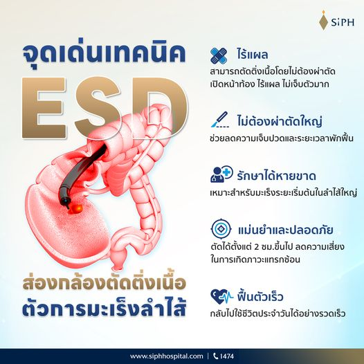 SiPHHospital's tweet photo. ไม่ต้องผ่าตัดใหญ่ ไร้แผล เจ็บน้อย ฟื้นตัวเร็ว
ด้วยเทคนิค ESD หรือเทคนิคส่องกล้องตัดติ่งเนื้อในลำไส้ ช่วยลดความเสี่ยงการเกิดมะเร็งลำไส้ได้
#ติ่งเนื้อในลำไส้ #ESD
#ศูนย์ทางเดินอาหารและตับ
#Keyforcare #กุญแจสำคัญของการรักษา
#SiPH #ศิริราชปิยมหาราชการุณย์ https://t.co/fquQL0QS4I