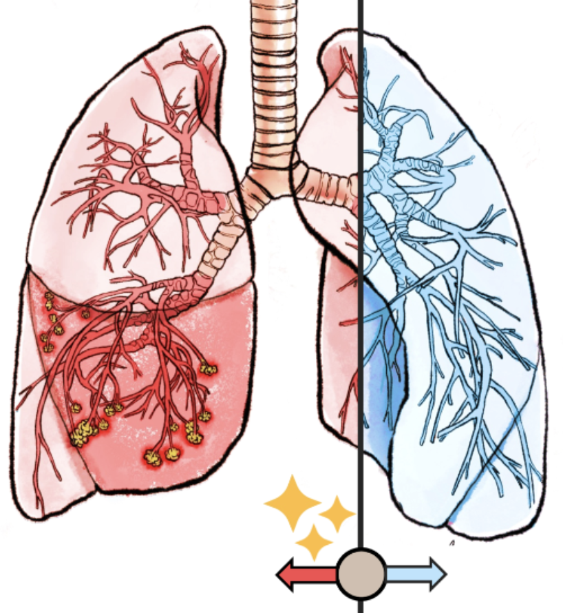 peterhan91's tweet image. Paper 🚨!  With @jnkath and @DanielTruhn, we wrote about  &quot;Reconstruction of patient-specific confounders in AI-based radiologic image interpretation using generative pertaining&quot; for  @CellRepMed  cell.com/cell-reports-m…
