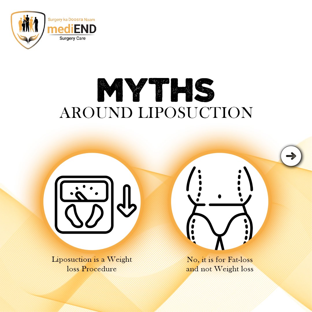 medi_end_'s tweet photo. Are you a candidate for liposuction?
Book your appointment now. https://t.co/AyB4CYLcQZ….
.
.
.
.
#Health #healthcare #mediend #mediendsurgery #treatment #liposuctionmagic #fatremoval #Tumescent #ultrasoundassisted #fatremovalsurgery #BodyTransformation #recoverwell https://t.co/2DEDtoL4l4