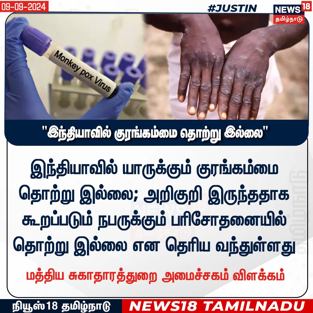 News18TamilNadu's tweet image. #JUSTIN 
இந்தியாவில் யாருக்கும் குரங்கம்மை தொற்று இல்லை - மத்திய சுகாதாரத்துறை அமைச்சகம்  
 #monkeybox #News18tamilnadu |  news18tamil.com