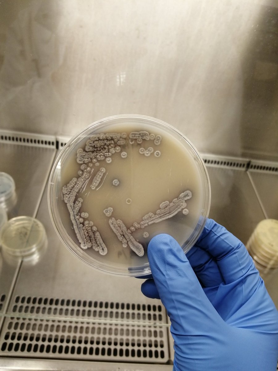Andreas Lawaetz (@hellomicrobe) on Twitter photo After three great years in the Denham Lab <a href="/Gingermicrobe/">Dr Emma Denham π©π»βπ¦°π§¬π§«π¦ π©βπ¬π¬π₯³</a> I have now found my way to the University of Strathclyde <a href="/PaulHoskisson/">Paul Hoskisson π·π¬π§«π§¬πΈππ¦</a> to work on most infamous Streptomyces. Thank you Emma for teaching me loads and thanks to the entire Hoskisson group for welcoming me wholeheartedly! After three great years in the Denham Lab <a href="/Gingermicrobe/">Dr Emma Denham π©π»βπ¦°π§¬π§«π¦ π©βπ¬π¬π₯³</a> I have now found my way to the University of Strathclyde <a href="/PaulHoskisson/">Paul Hoskisson π·π¬π§«π§¬πΈππ¦</a> to work on most infamous Streptomyces. Thank you Emma for teaching me loads and thanks to the entire Hoskisson group for welcoming me wholeheartedly!