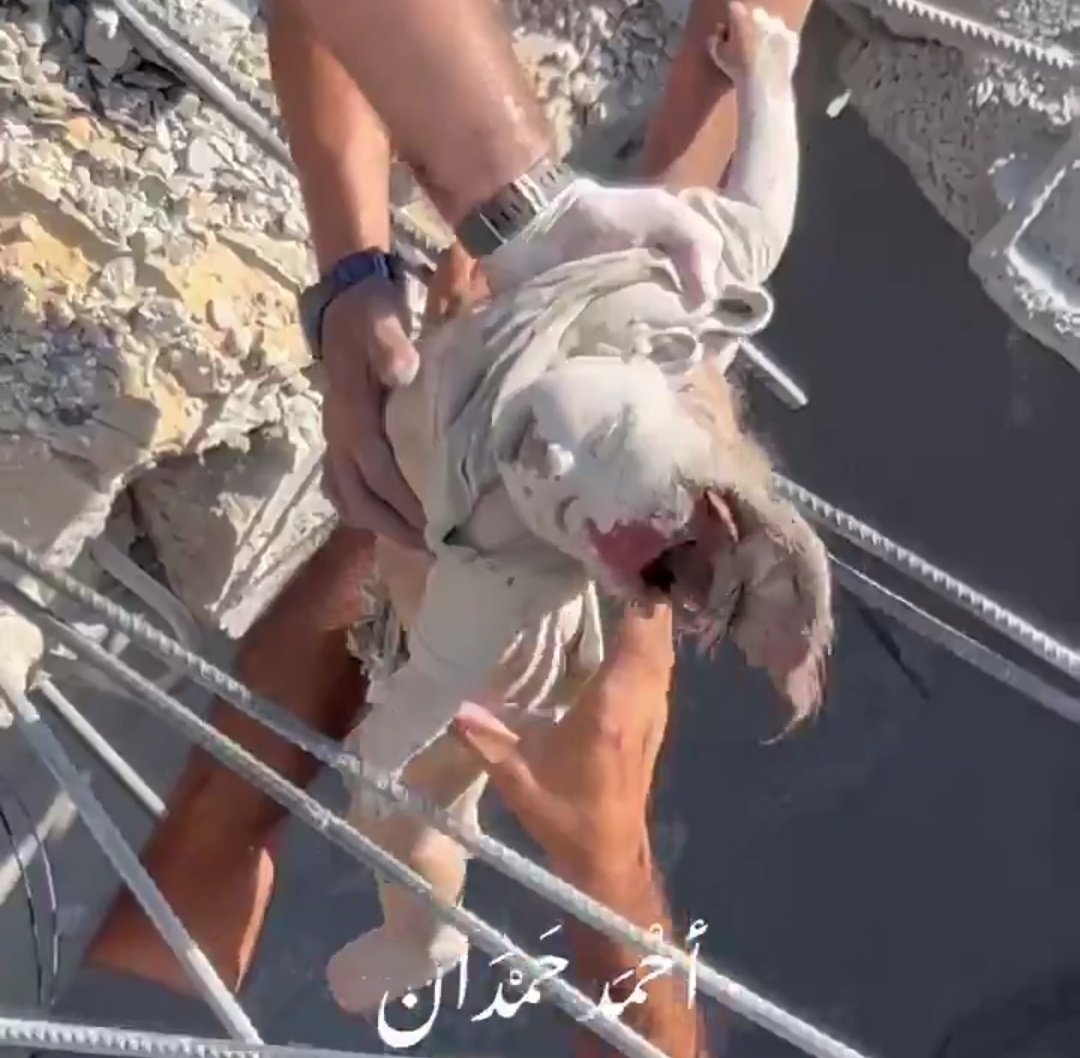 مشهد مُفزع، لقد سحقت اسرائيل رأس هذه الطفلة إلى نصفين قبل قليل في غزة.

الكوكب الأعمى يجب أن يرى هذه المشاهد، يجب أن لا نغمض أعيننا عنها.