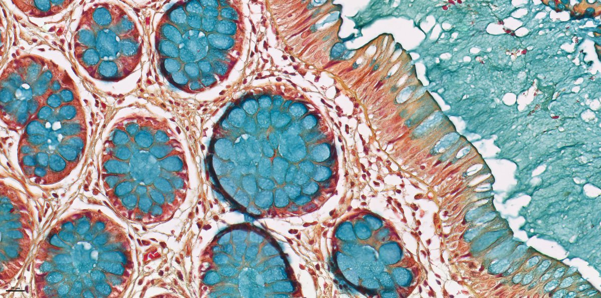 Make  Colon  Beautiful Again! 
(We totally need this printed on a hat). 

This week we are learning how to use the Movat Pentachrome stain.