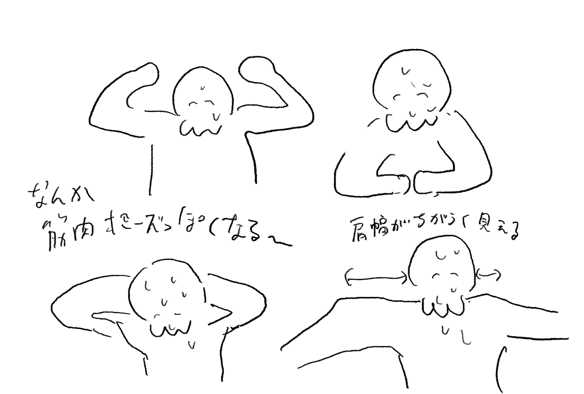 腕の腫れを確認するために鏡の前でポーズとっていたらめちゃくちゃ筋肉ポーズになる 