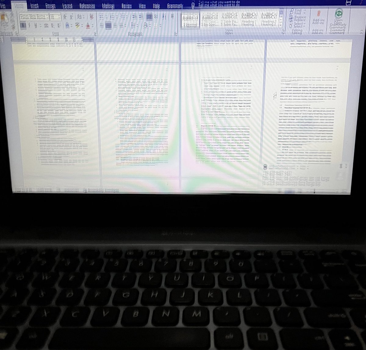 yummieswork's tweet image. tetap ngejoksss walaupun lagi sakit. terima kasih yg sudah mempercayakan tugasnya kepada yummieswork 💙