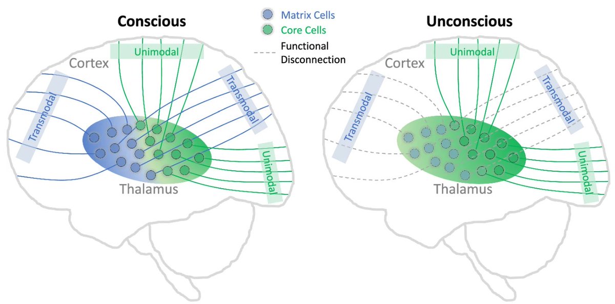 Drs. Zirui Huang, George Mashour, and Tony Hudetz publish new work in Nature Communications today. They identify the role of core-matrix architecture and human thalamocortical connectivity in conscious state transitions induced by the anesthetic propofol. nature.com/articles/s4146…