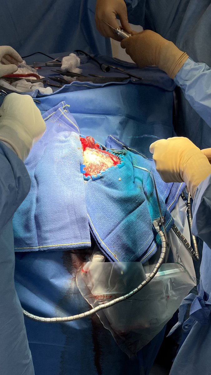 yaabhh's tweet photo. Neurochirurgie 🧠💫 https://t.co/XJ6ORydpzo
