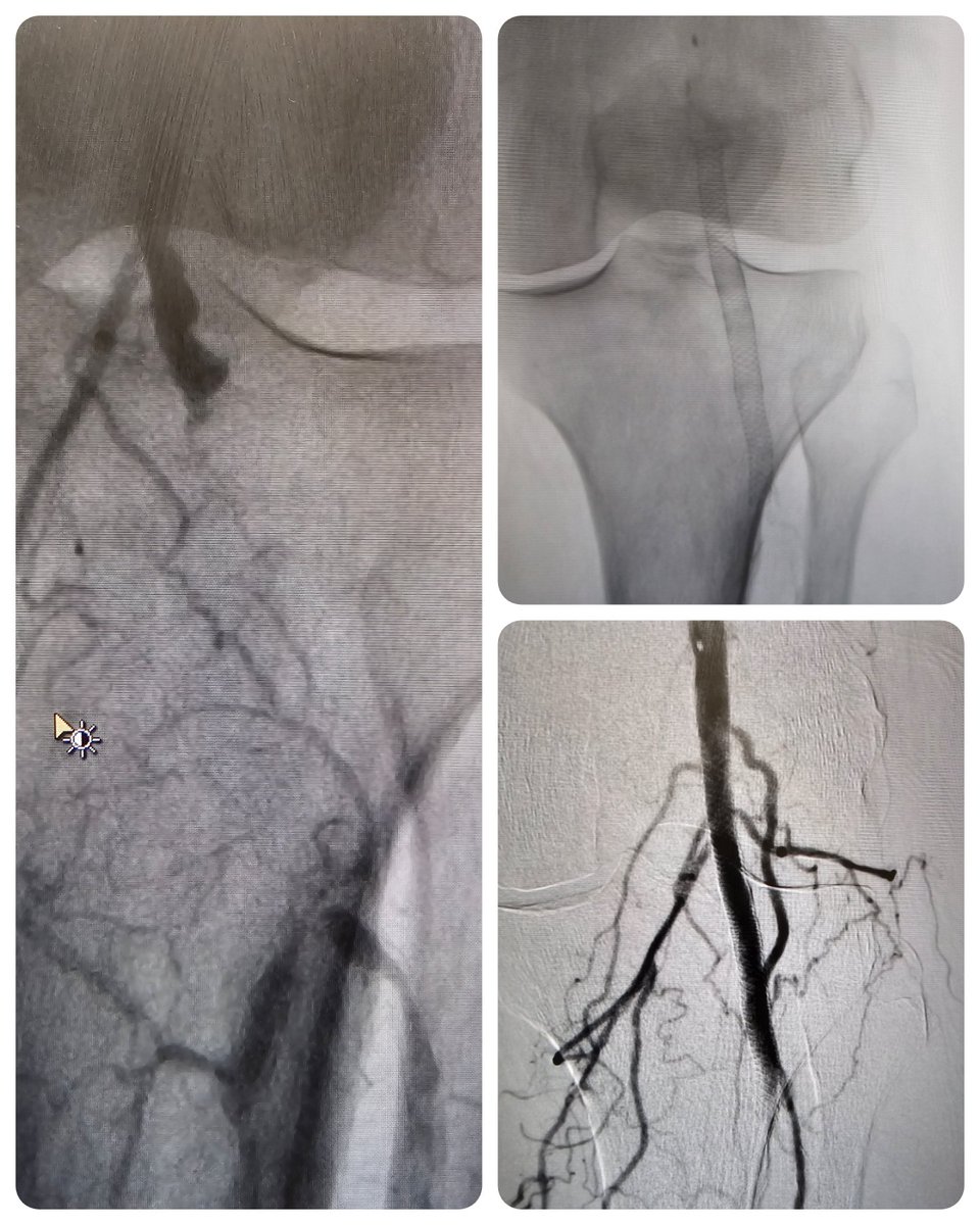 Shuo (Chris) Li tweet media