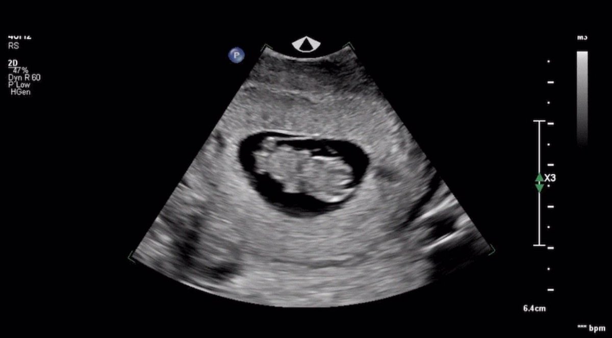 emilineorf's tweet photo. Fast twitch coming in March 4th, 2025! @orfsam https://t.co/aFqo3UXGh1