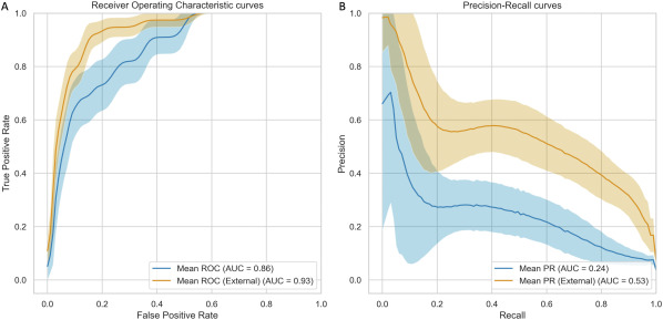 Ophthalmology (@aaojournal) on Twitter photo Predicting Choroidal Nevus Transformation to Melanoma Using Machine Learning
ow.ly/NsAv50SK7Ni
<a href="/PrashantDTailor/">Prashant Tailor</a>
#ophthalmology Predicting Choroidal Nevus Transformation to Melanoma Using Machine Learning
ow.ly/NsAv50SK7Ni
<a href="/PrashantDTailor/">Prashant Tailor</a>
#ophthalmology