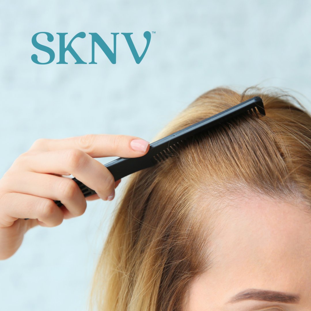 SKNV tweet media