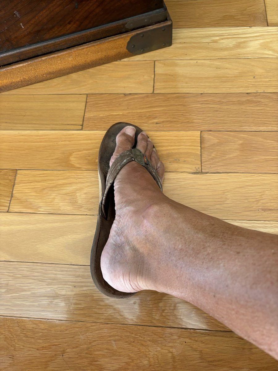 DrRobertKlapper's tweet image. KLAPPERVISION. Excited to see AaronRogers Achilles tonight on MNF! This Repair was not Tendon to Tendon but Tendon to Bone! #SpeedBridge