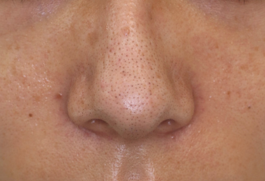 ジェーン tweet media