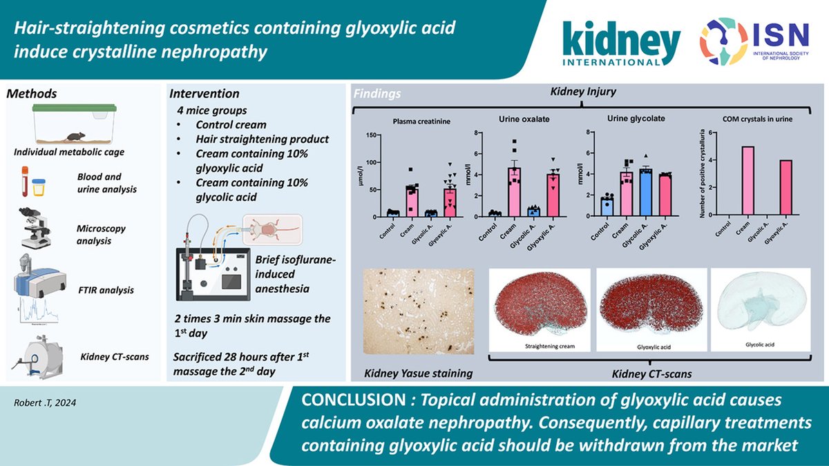 Kidney International (@kidney_int) on Twitter photo Hair-straightening cosmetics containing glyoxylic acid induce crystalline nephropathy
doi.org/10.1016/j.kint…
<a href="/nephrobug/">thomas robert</a> <a href="/APHP/">Assistance Publique – Hôpitaux de Paris (AP-HP)</a> <a href="/Inserm/">Inserm</a>
#acutekidneyinjury #AKI Hair-straightening cosmetics containing glyoxylic acid induce crystalline nephropathy
doi.org/10.1016/j.kint…
<a href="/nephrobug/">thomas robert</a> <a href="/APHP/">Assistance Publique – Hôpitaux de Paris (AP-HP)</a> <a href="/Inserm/">Inserm</a>
#acutekidneyinjury #AKI
