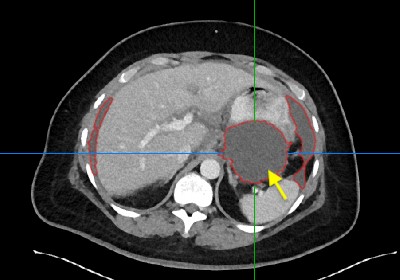 Radiology: Artificial Intelligence tweet media