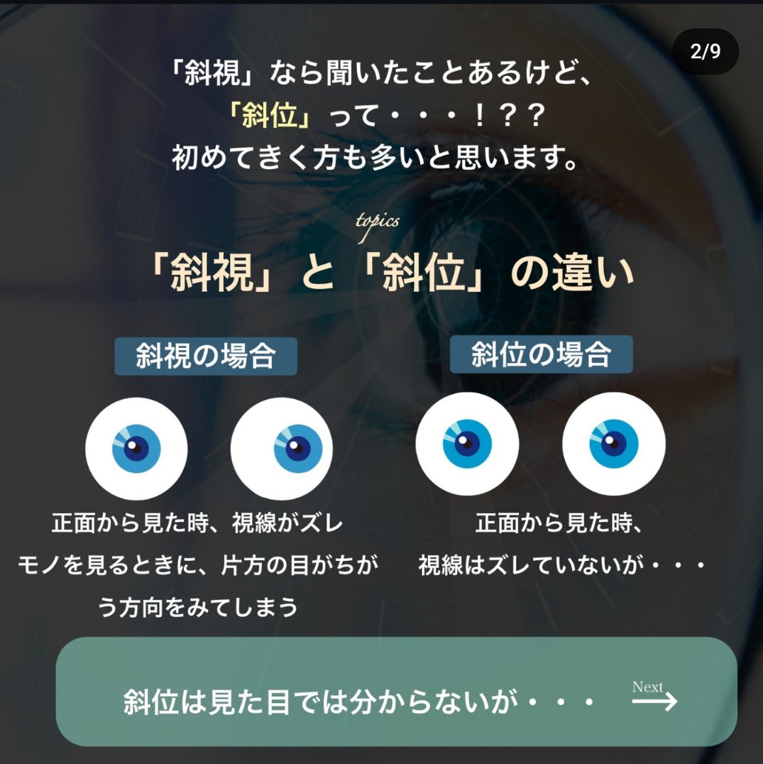 Sherwin_megane's tweet photo. 貴方のその眼精疲労や頭痛、斜位が原因かも！？😣

そもそも、斜位って何？斜視と何が違うの？
どうやって眼精疲労や頭痛が楽になるの？

そんな疑問、全てグラスファクトリーにお任せあれ♪
グラスファクトリーでは、両眼視機能検査を行っており、改善にピッタリのレンズ、度数を提案します👍
↓続き https://t.co/6271dS3j6j