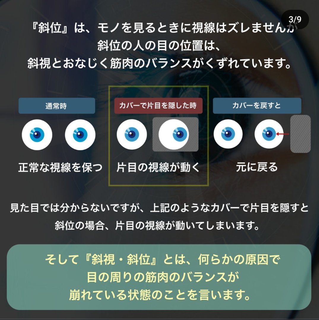 Sherwin_megane's tweet photo. 貴方のその眼精疲労や頭痛、斜位が原因かも！？😣

そもそも、斜位って何？斜視と何が違うの？
どうやって眼精疲労や頭痛が楽になるの？

そんな疑問、全てグラスファクトリーにお任せあれ♪
グラスファクトリーでは、両眼視機能検査を行っており、改善にピッタリのレンズ、度数を提案します👍
↓続き https://t.co/6271dS3j6j