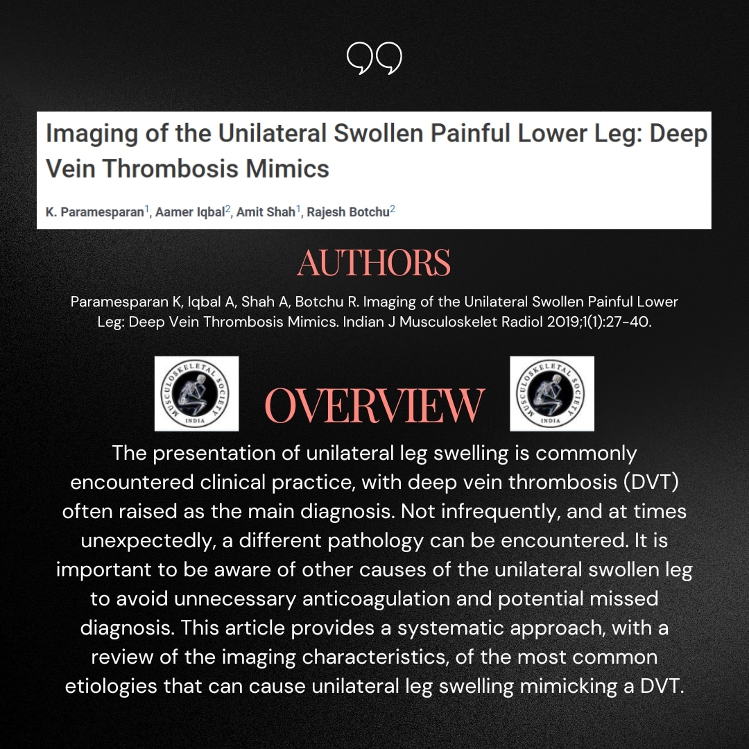 MSKSocietyIndia's tweet photo. Article in review for the week:
"Imaging of the unilateral swollen painful lower leg"
Paramesparan K, Iqbal A, Shah A, Botchu R. Imaging of the Unilateral Swollen Painful Lower Leg: Deep Vein Thrombosis Mimics.Indian J Musculoskelet Radiol 2019;1(1):27-40
#mskRad #msk #FOAMRad https://t.co/uIDyBjMt1Q