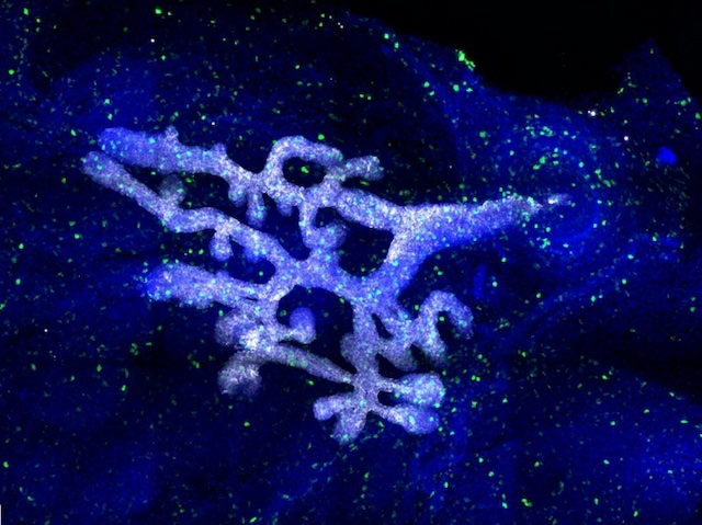 Biomedical Picture of the Day BPoD (@bpod_s) on Twitter photo Committing to mammary gland development – the paths taken by stem cells
📷 : <a href="/Claudia_CG_/">Claudia Carabaña</a> et al <a href="/BethLloydLewis/">Bethan Lloyd-Lewis</a> @slvfre <a href="/institut_curie/">Institut Curie</a> in <a href="/embojournal/">The EMBO Journal</a>
➡️ : bpod.org.uk/archive/2024/9… Committing to mammary gland development – the paths taken by stem cells
📷 : <a href="/Claudia_CG_/">Claudia Carabaña</a> et al <a href="/BethLloydLewis/">Bethan Lloyd-Lewis</a> @slvfre <a href="/institut_curie/">Institut Curie</a> in <a href="/embojournal/">The EMBO Journal</a>
➡️ : bpod.org.uk/archive/2024/9…