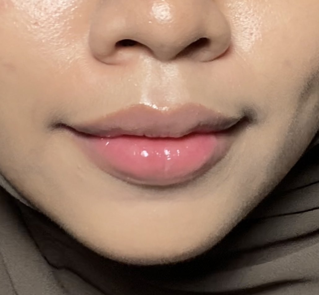 senshineey's tweet photo. TELAH HADIR LIP SERUM NEXT LEVEL🫵🏼🫵🏼

ga lengket &amp; lembabnya awett.. bisa dipake under lip produk juga

AND LOOK!! packagingnya cantik dan enak bgt, ga perlu colak colek pake tangan😭🫶🏼

#BrightSmoothEven #SKINTIFICLipSerum #racuninskincare https://t.co/phu8WxiV19