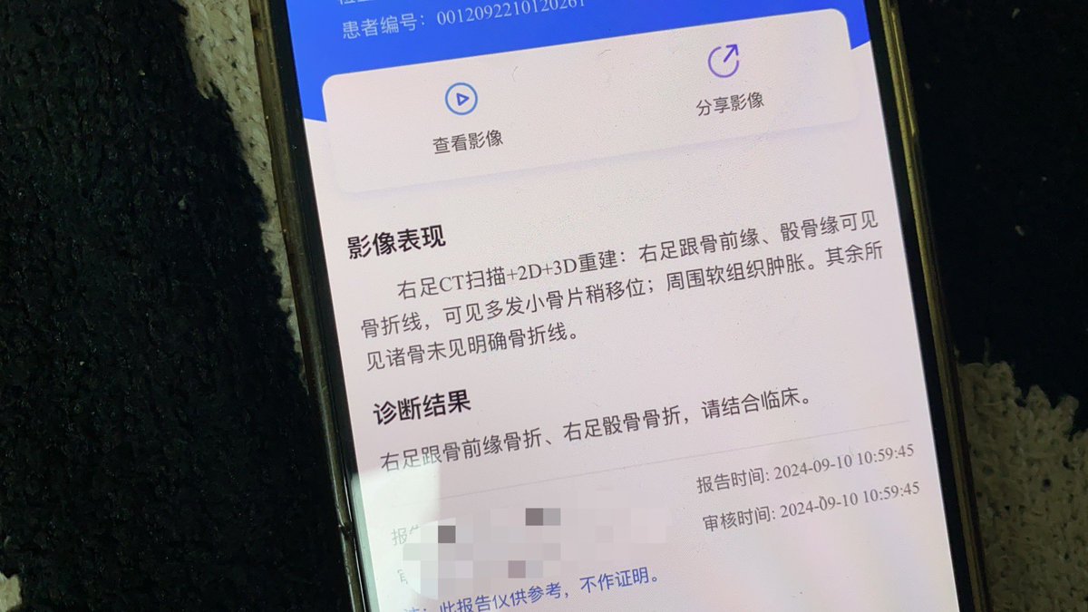 我想说我右脚骨折了。我去兰卡大概只能躺在床上和你们犯贱了。想想床上怎么拍视频吧。还有拄拐拍你们会不会嫌弃我。又开始焦虑。好想马上下地啊。 https://t.co/w1nd5Wukjv