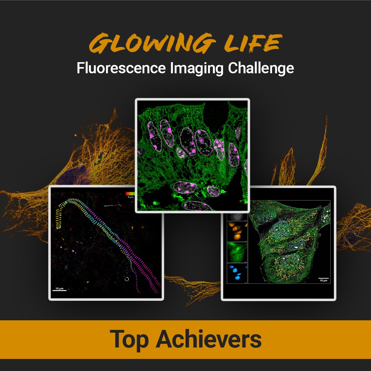 🎉 The Glowing Life Challenge has concluded, and our winners have been selected!  Visit our website to see who excelled in the “Any ATTO Dye” and “ATTO Labeling Kits” categories.

👉 atto-tec.com/info/winner-gl…

#GlowingLifeChallenge #Innovation #ScienceExcellence