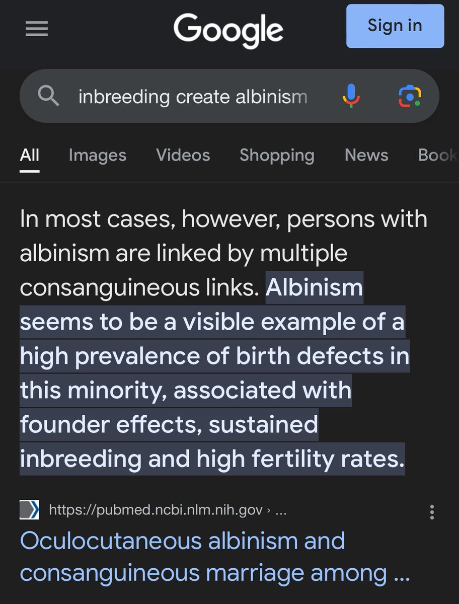 FullExposure_'s tweet photo. @hartgoat pale ppl hate back ppl because pale ppl hate their parents, and black ppl are ultimately their parents lol.. pale ppl came from albino africans &amp; black africans.. albinos come from inbreeding, ie pale tigers.. then albinos interbred for 100s of yrs &amp; created a pale (“white”) race https://t.co/7OCSxqViPw