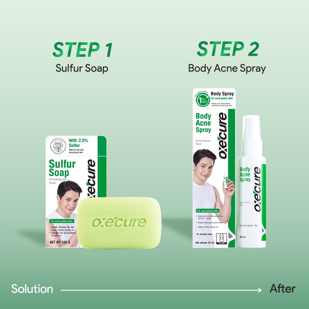 Oxecure_QA's tweet photo. Swipe ➡️ to reveal real results against stubborn body acne with the help of the acne experts! 💯

Shop the Oxecure Sulfur Soap and Body Acne Spray now at the #linkinbio 🛒 #OxecureQA #OxecureQatar #OxecureInControl https://t.co/IEabtd8fqU