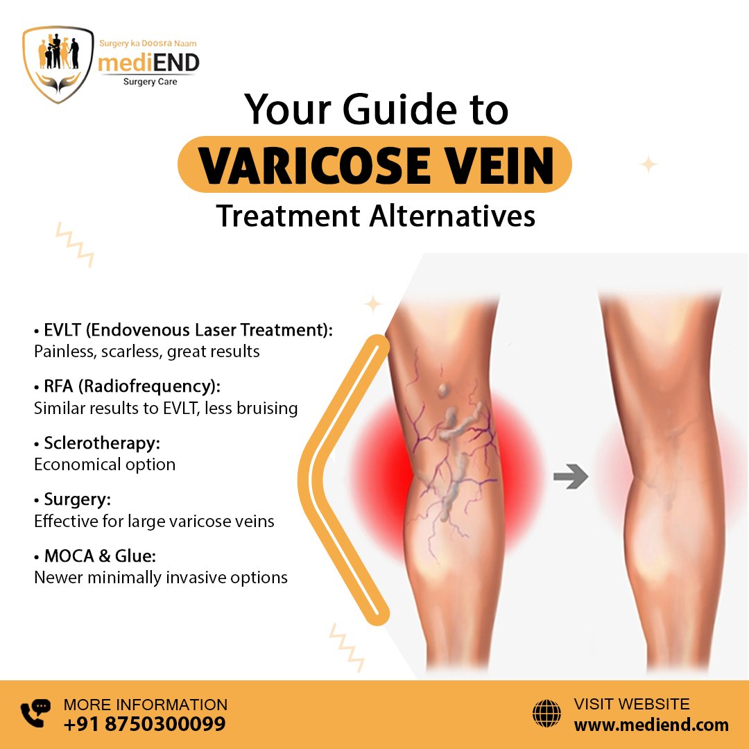 medi_end_'s tweet photo. Get rid of varicose veins with expert care in Hyderabad at mediEND Surgery Care!
Book your appointment now: https://t.co/j2uFWEGviV
.
.
.
.
#Health #healthcare #mediend #mediendsurgery #veindisease #varices #varicoseveinremoval #vein #muscleexercises #anklejointmovement #evlt https://t.co/Xr1BMZzYkf