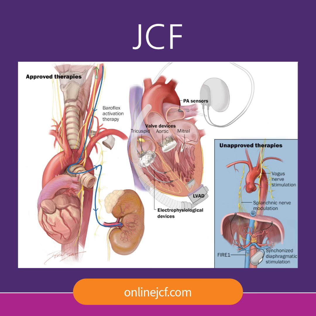 JCardFail's tweet photo. Understand the latest guidelines for HF device therapies &amp; how patient selection &amp; implementation can be optimized in HF workflows.

✅ Remote monitoring
✅ Valvular- &amp; structural-based therapies
✅ Autonomic, EP &amp; respiratory modulators
✅ Durable MCS

🔗 https://t.co/wRZYTCN92v https://t.co/22f4obchUE