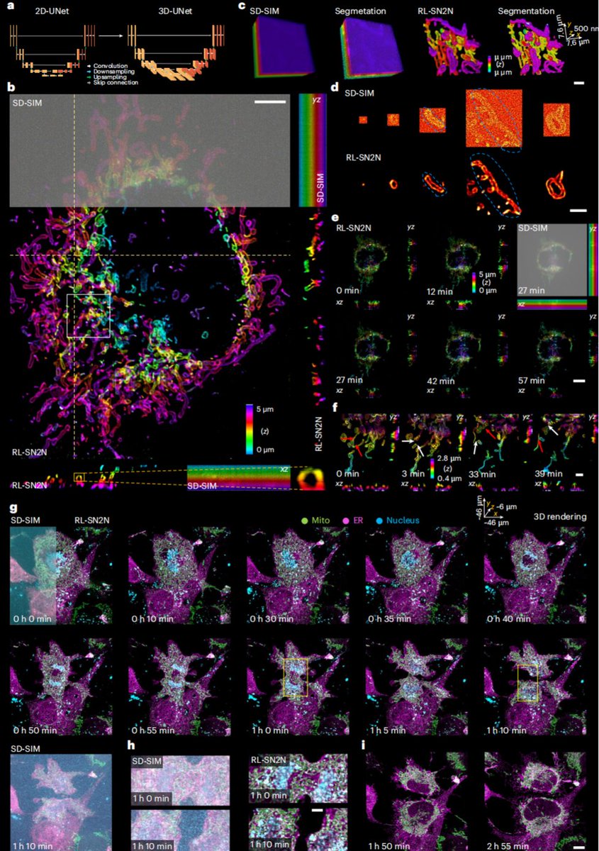 weisong_zhao's tweet image. Out at @naturemethods just now!

nature.com/articles/s4159…

We present #SN2N, a flagship level unsupervised denoising solution. It’s fully competitive with supervised learning without needing large training-set and clean ground-truth, using 1 noisy frame for training.

(1/n)