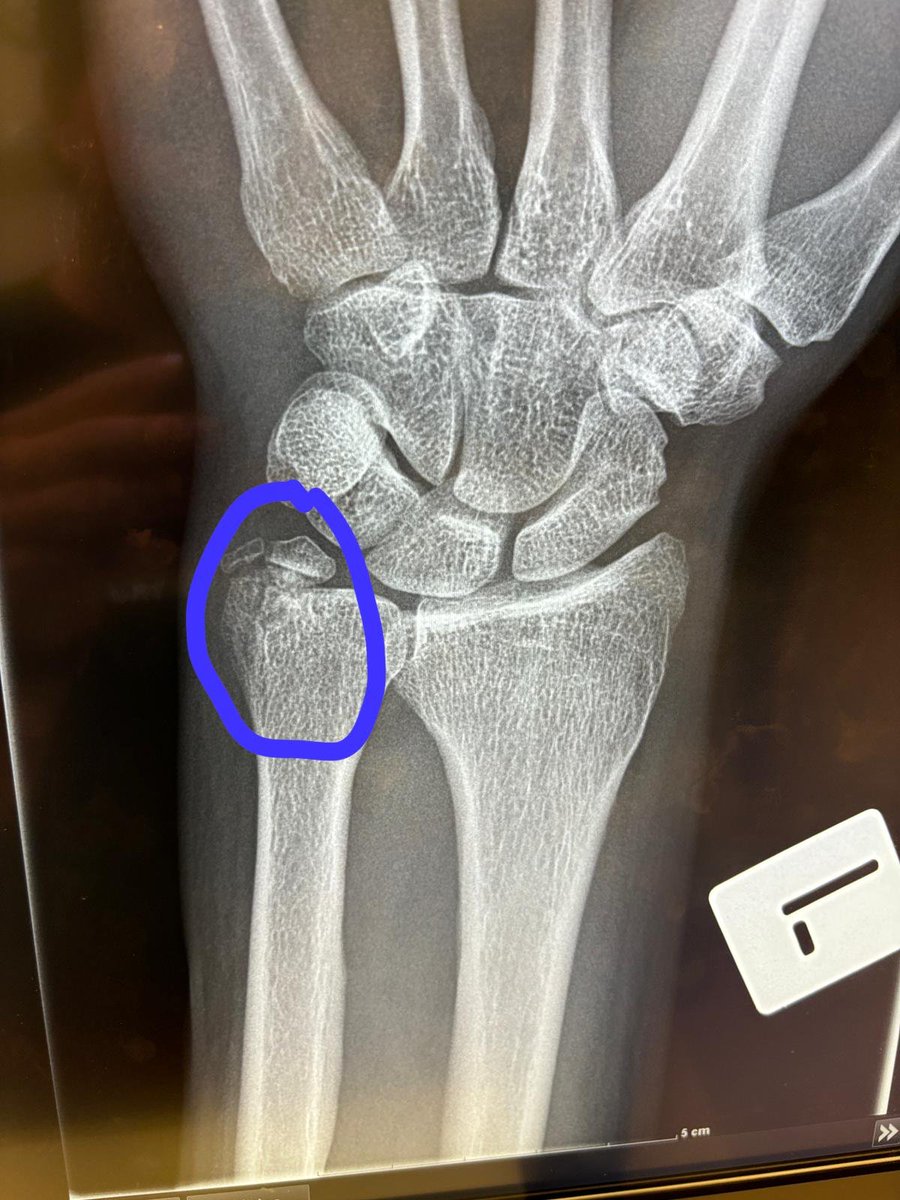 ClaringtonCubs's tweet photo. Fastball 1 Luke 0 
End of the season for this guy 
But we took ends of the DH to finish the regular 15-8-2 2nd in the East

East playoffs start Saturday https://t.co/maEsm3EgIr